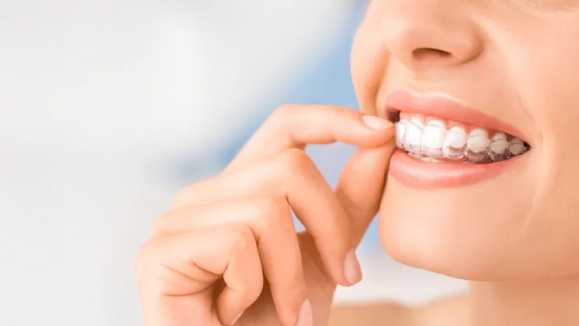 Alinhador invisível transparente sendo posicionado em arcada dentária, material acrílico translúcido de alta qualidade, mãos delicadas com luvas brancas, fundo clean minimalista bege, iluminação suave e profissional, fotografia odontológica detalhada, composição elegante e discreta